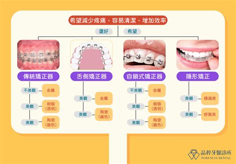 方形矯正線作用|矯正器的種類介紹